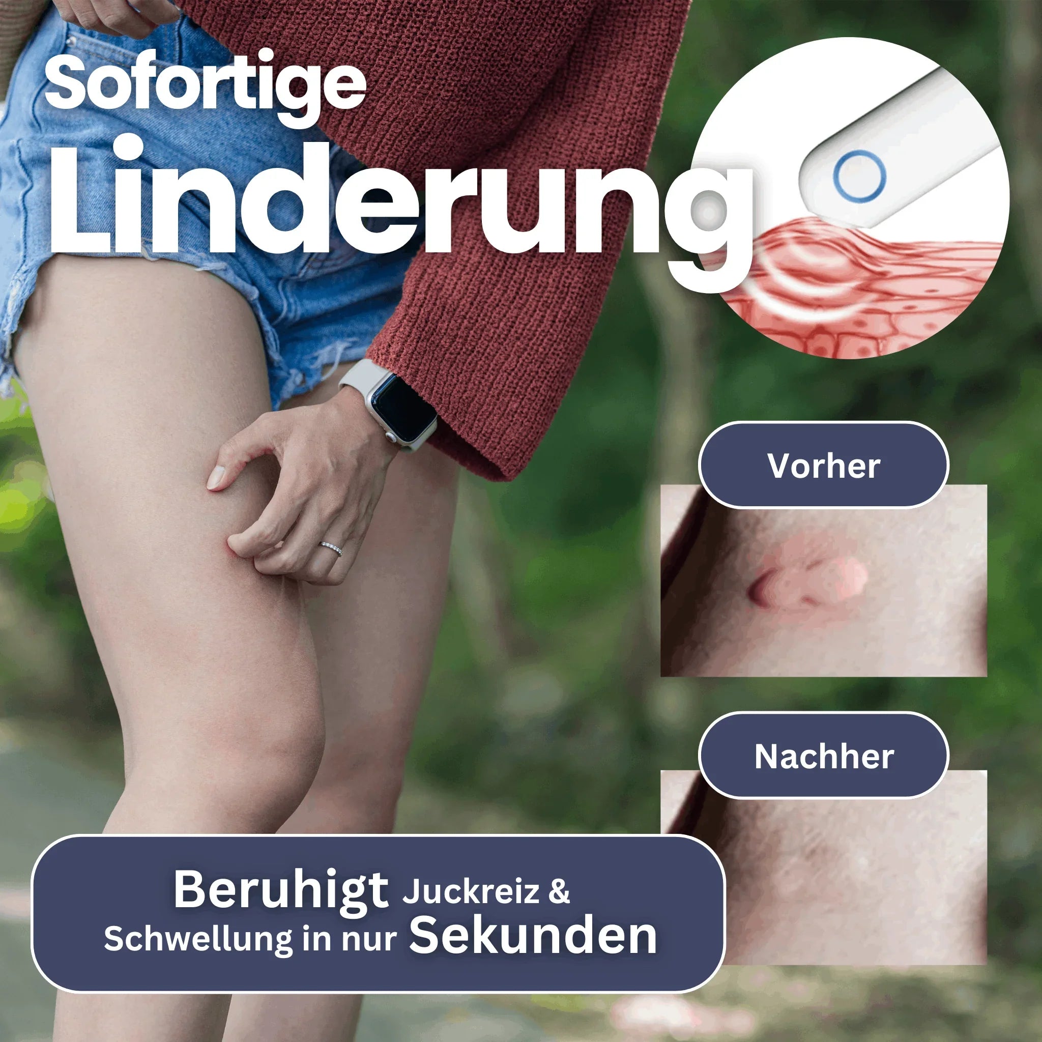 Electronic Anti-Itch Pen