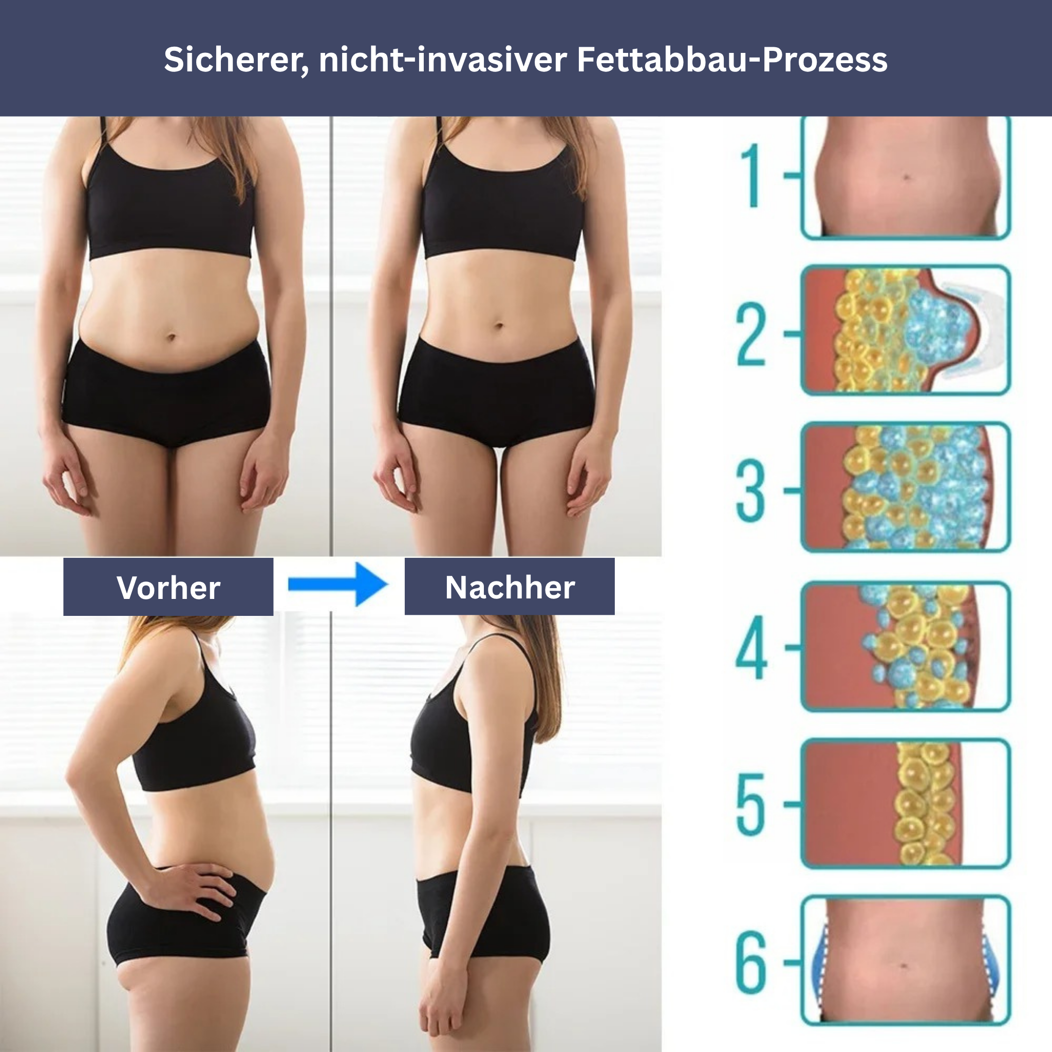 IceContour – Massage device for belly & cellulite