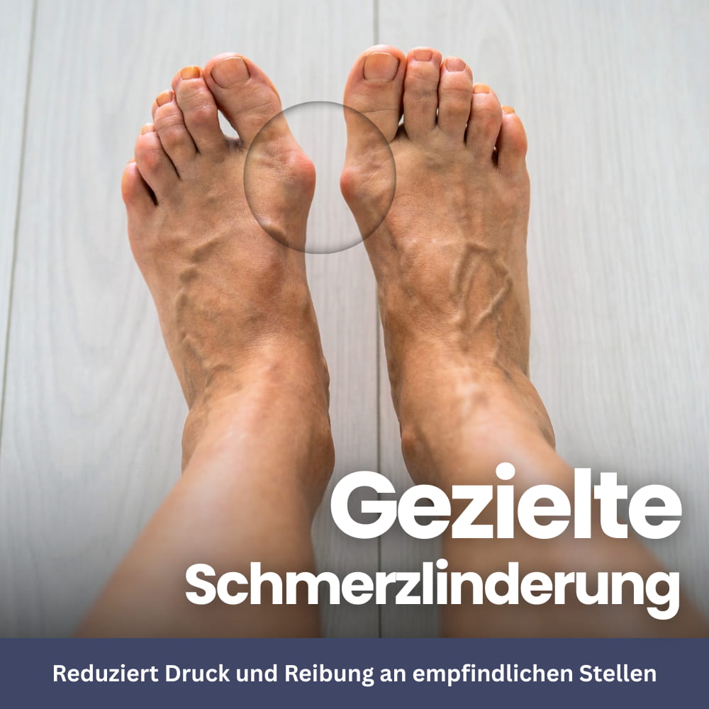 SoftAlign – Toe Protector & Bunion Corrector