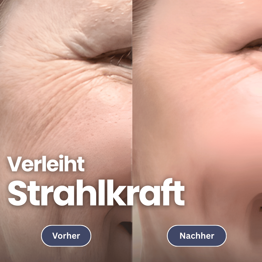 Microneedling Infusion Set for Firmer Skin